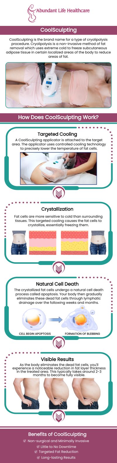 CoolSculpting is a non-invasive body contouring treatment that targets and freezes fat cells, helping you achieve a slimmer, more sculpted look. Visit Dr. Marc Jean-Gilles, DO, FACOG, to learn more about how CoolSculpting can help you with your body goals. For more information, contact us today or book an appointment online. We are conveniently located at 601A Professional Drive, Suite 370, Lawrenceville, GA 30046.